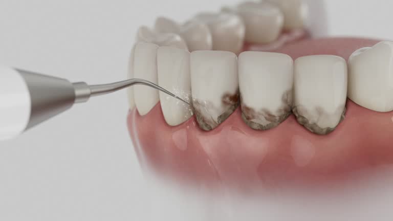 Trusted Teeth Cleaning And Checkup service in Herald, CA - Dentist Open Now